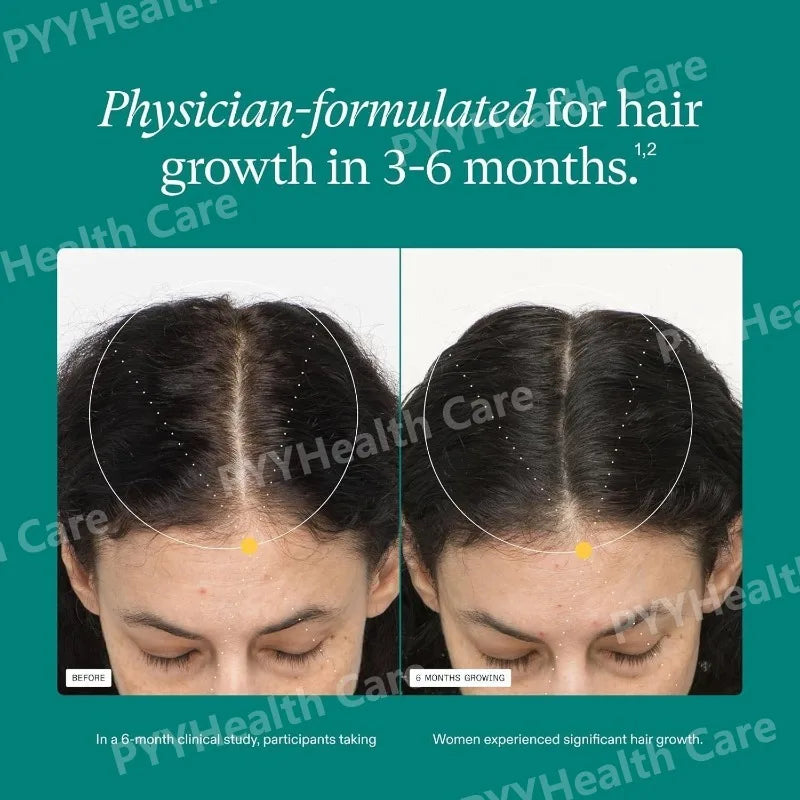 Women's Hair Growth Supplements, Clinically Proven for Visibly Thicker and Stronger Hair, Dermatologist Recommended